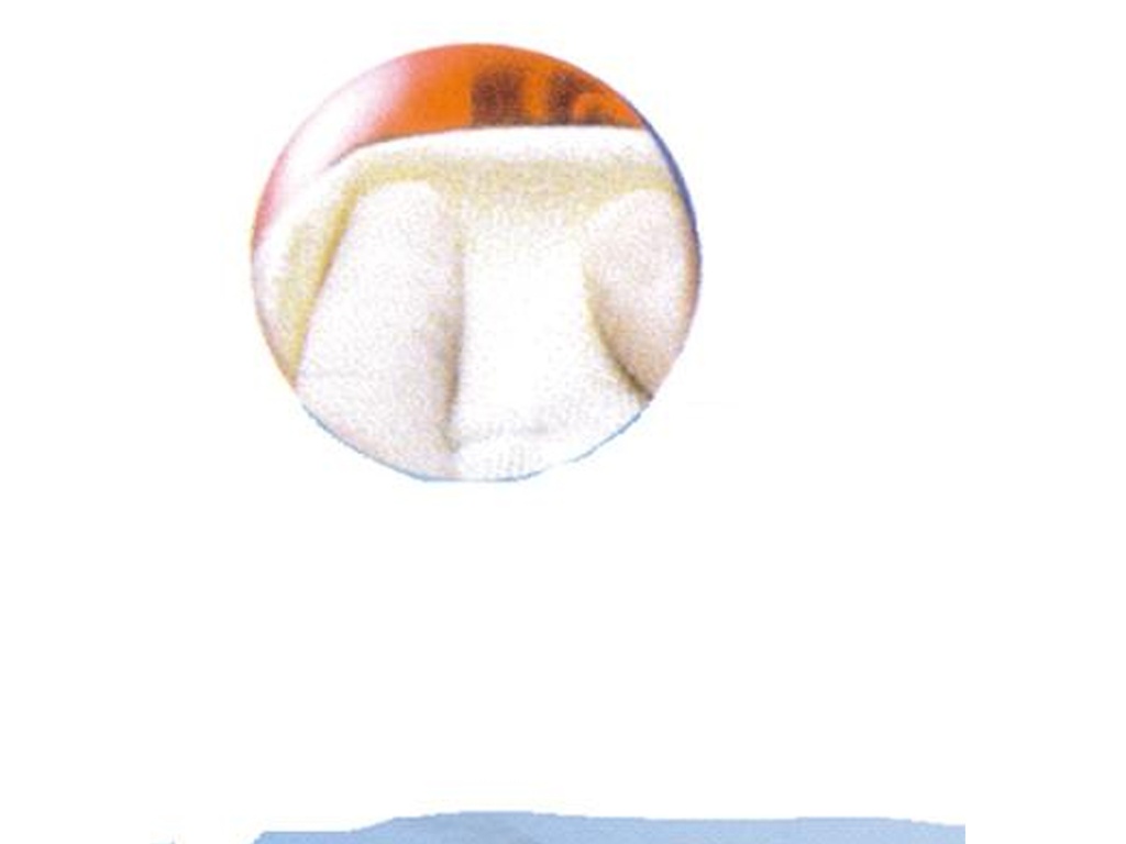 Surgicel Nu-Knit 12 u. 2,5cm x 2,5cm - Johnson&amp;Johnson