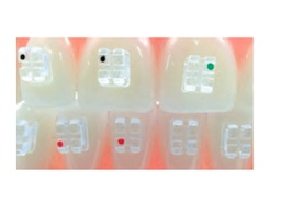[050021] Brackets Roth zafiro Slot 0,22